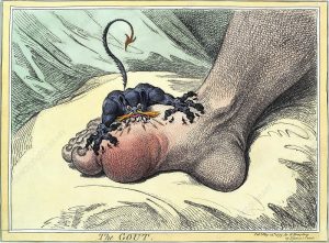gota, gout